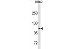 Western Blotting (WB) image for anti-Calsyntenin 2 (CLSTN2) antibody (ABIN3001117)