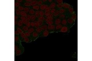 IF Analysis of transfected PFA-fixed MCF7 cells labeling HA-recombinant protein. (HA-Tag antibody)