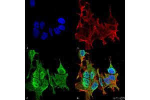 Immunocytochemistry/Immunofluorescence analysis using Mouse Anti-Ankyrin B Monoclonal Antibody, Clone S105-13 . (ANK2 antibody  (AA 203-496) (FITC))