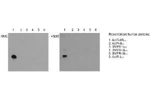 Western blot with extracellular domains (ecd) of different related human receptors (50ng per lane) reveals that anti-Activin Receptor IIB, pAb (IG-510)  (dilution 1:5000) specifically recoginzes ACTR-IIB under nonreducing (-ßME, left panel) and reducing (+ßME; right panel) conditions, but none of the other receptor types tested. (ACVR2B antibody  (Extracellular Domain))