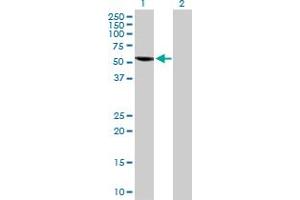 Western Blot analysis of SPAG6 expression in transfected 293T cell line by SPAG6 MaxPab polyclonal antibody. (SPAG6 antibody  (AA 1-509))