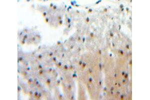 Used in DAB staining on fromalin fixed paraffin-embedded Brain tissue (CENPI antibody  (AA 321-579))
