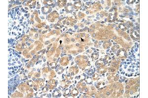Immunohistochemistry (IHC) image for anti-Tetraspanin 5 (TSPAN5) (Middle Region) antibody (ABIN2782690) (Tetraspanin 5 antibody  (Middle Region))