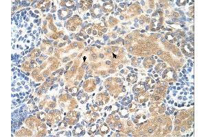 Immunohistochemistry (IHC) image for anti-Tetraspanin 5 (TSPAN5) (Middle Region) antibody (ABIN2782690) (Tetraspanin 5 antibody  (Middle Region))