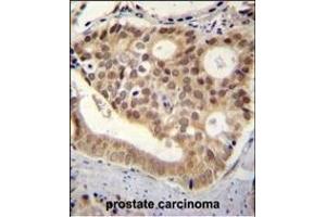 C11orf53 antibody (C-term) (ABIN654875 and ABIN2844531) immunohistochemistry analysis in formalin fixed and paraffin embedded human pancreas tissue followed by peroxidase conjugation of the secondary antibody and DAB staining. (C11orf53 antibody  (C-Term))