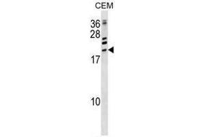 ATF3 Antibody (C-term) western blot analysis in CEM cell line lysates (35ug/lane). (ATF3 antibody  (C-Term))