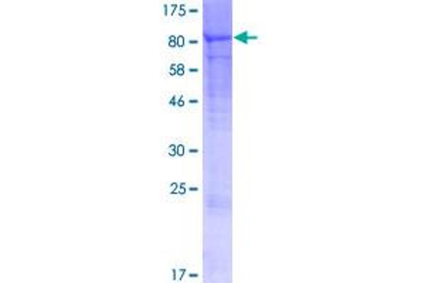 EPB42 Protein (AA 1-619) (GST tag)