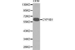 Western blot analysis of extracts of CEM cell lines, using CYP1B1 antibody. (CYP1B1 antibody  (AA 1-260))