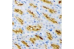 Immunohistochemical analysis of Clathrin Heavy Chain staining in rat kidney formalin fixed paraffin embedded tissue section. (Clathrin Heavy Chain (CLTC) antibody)