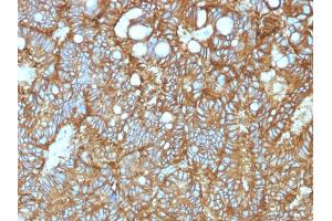 Immunohistochemistry (IHC) image for anti-Epithelial Cell Adhesion Molecule (EPCAM) (AA 77-202), (Extracellular Domain) antibody (ABIN6939977)