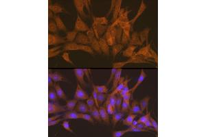 Immunofluorescence analysis of NIH-3T3 cells using PRKACB Rabbit pAb (ABIN6132241, ABIN6146183, ABIN6146184 and ABIN6220953) at dilution of 1:100 (40x lens). (PRKACB antibody  (AA 1-351))