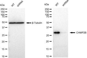 Western blotting analysis using CHMP2B antibody (ABIN7798031).