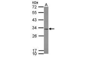 Image no. 1 for anti-Coiled-Coil Domain Containing 44 (CCDC44) (AA 9-105) antibody (ABIN1501284)