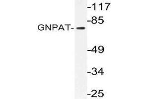 Western blot (WB) analysis of GNPAT antibody in extracts from HT-29 cells. (GNPAT antibody)