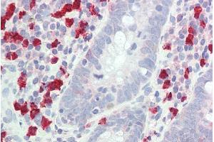 ABIN302137 (5µg/ml) staining of paraffin embedded Human Small Intestine. (GCH1 antibody  (Internal Region))