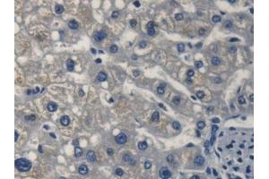 DAB staining on IHC-P; Samples: Human Liver Tissue (FKBP2 antibody  (AA 1-142))