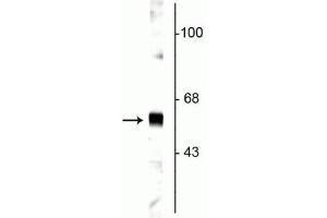 Western blot of rat cortical lysate showing specific labeling of the ~65 kDa synaptotagmin protein. (SYT1 antibody)