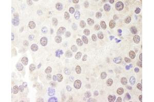 Immunohistochemistry (IHC) image for anti-Multiple Endocrine Neoplasia 1 (MEN1) (C-Term) antibody (ABIN7448666) (Menin antibody  (C-Term))