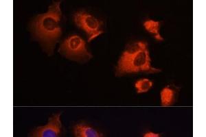Immunofluorescence analysis of A431 cells using MCL1 Polyclonal Antibody at dilution of 1:100 (40x lens). (MCL-1 antibody)