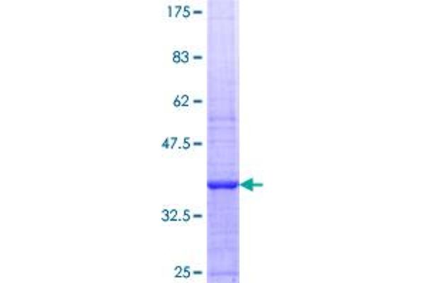 RecQ Protein-Like (DNA Helicase Q1-Like) (RECQL) (AA 549-648) protein (GST tag)