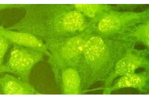 Immunofluorescence (IF) image for anti-E3 ubiquitin-protein ligase RAD18 (RAD18) (C-Term) antibody (ABIN2452086) (RAD18 antibody  (C-Term))