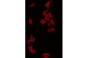 ABIN6266993 staining RAW264. (PFDN1 antibody  (Internal Region))