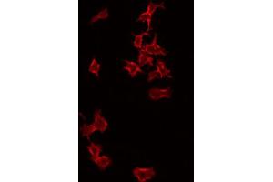 ABIN6266993 staining RAW264. (PFDN1 antibody  (Internal Region))