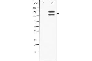 Western blot analysis of FGFR1 phosphorylation expression in 293 whole cell lysates,The lane on the left is treated with the antigen-specific peptide. (FGFR1 antibody  (pTyr154))