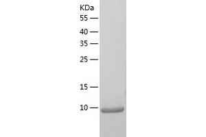 Western Blotting (WB) image for Chemokine (C-X-C Motif) Ligand 5 (CXCL5) (AA 41-114) protein (His tag) (ABIN7286141) (CXCL5 Protein (AA 41-114) (His tag))
