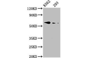 Western Blot Positive WB detected in: K562 whole cell lysate, 293 whole cell lysate All lanes: BMPR1A antibody at 3. (BMPR1A antibody  (AA 177-532))