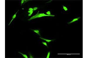 Immunofluorescence of purified MaxPab antibody to ANXA1 on HeLa cell. (Annexin a1 antibody  (AA 1-346))
