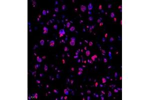 Immunofluorescence of paraffin embedded mouse placenta using Skar (ABIN7074970) at dilution of 1:950 (400x lens) (p46 antibody)