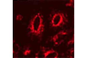 LAMP1 Immunofluorescence. (LAMP1 antibody)