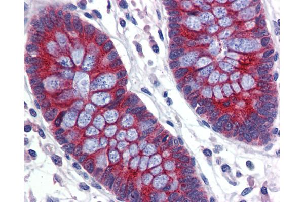 ABCA5 antibody  (AA 1296-1345)