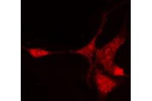 Immunofluorescence (fixed cells) (IF/ICC) image for anti-Nuclear Receptor Subfamily 1, Group I, Member 3 (NR1I3) (Internal Region) antibody (ABIN6263717)