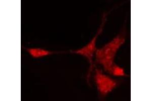 ABIN6276988 staining Hela cells by IF/ICC. (NR1I3 antibody  (Internal Region))