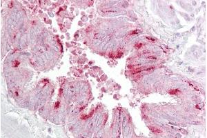 Immunohistochemistry (IHC) image for anti-Eukaryotic Translation Initiation Factor 4E (EIF4E) (C-Term) antibody (ABIN2778784)