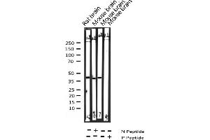 Western blot analysis of Phospho-Synaptotagmin (Ser309) expression in various lysates (Synaptotagmin antibody  (pSer309))