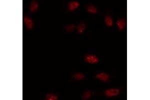 Immunofluorescence (fixed cells) (IF/ICC) image for anti-SNAIL (SNAI1) (C-Term) antibody (ABIN6265200)