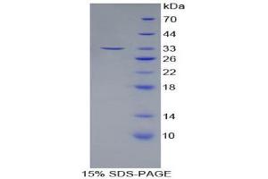SDS-PAGE (SDS) image for Angiopoietin-Like 3 (ANGPTL3) (AA 22-281) protein (His tag) (ABIN2124009) (ANGPTL3 Protein (AA 22-281) (His tag))
