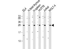 All lanes : Anti-TIGIT Antibody at 1:2000 dilution Lane 1: EL4 whole cell lysate Lane 2: human fetal thymus lysate Lane 3: human spleen lysate Lane 4: HUT78 whole cell lysate Lane 5: Jurkat whole cell lysate Lane 6: MOLT-4 whole cell lysate Lysates/proteins at 20 μg per lane. (TIGIT antibody  (AA 12-142))