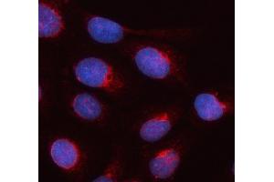 IF analysis of SEC22B using anti-SEC22B antibody (ABIN7602121). (SEC22B antibody  (AA 6-197))