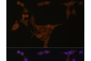 Immunofluorescence analysis of HeLa cells using PPAT Polyclonal Antibody at dilution of 1:100 (40x lens). (PPAT antibody)