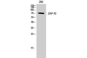 Western Blotting (WB) image for anti-zeta-Chain (TCR) Associated Protein Kinase 70kDa (ZAP70) (Tyr349) antibody (ABIN3187521) (ZAP70 antibody  (Tyr349))