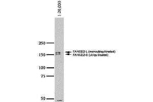 Image no. 1 for anti-Fanconi Anemia, Complementation Group D2 (FANCD2) (N-Term) antibody (ABIN363390) (FANCD2 antibody  (N-Term))