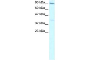 Western Blotting (WB) image for anti-TATA Box Binding Protein (TBP) antibody (ABIN2463874) (TBP antibody)