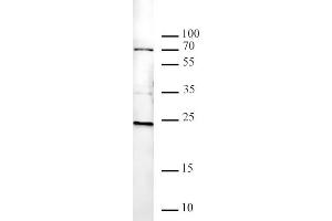 Histone H2AK119ub antibody tested by Western blot. (Histone H2A antibody  (ubLys119))