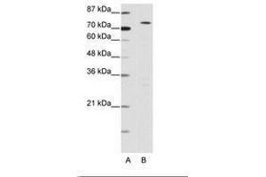 Image no. 1 for anti-MYST Histone Acetyltransferase 2 (MYST2) (N-Term) antibody (ABIN6736157) (MYST2 antibody  (N-Term))