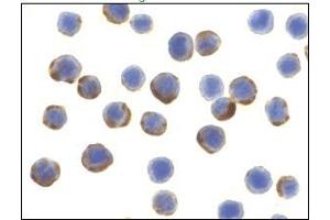 Immunocytochemistry of ATG7 in MCF7 cells with ATG7 Antibody at 10 μg/ml. (ATG7 antibody  (C-Term))