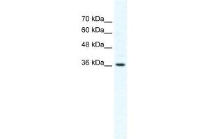 DVL1 antibody used at 2. (DVL1 antibody)